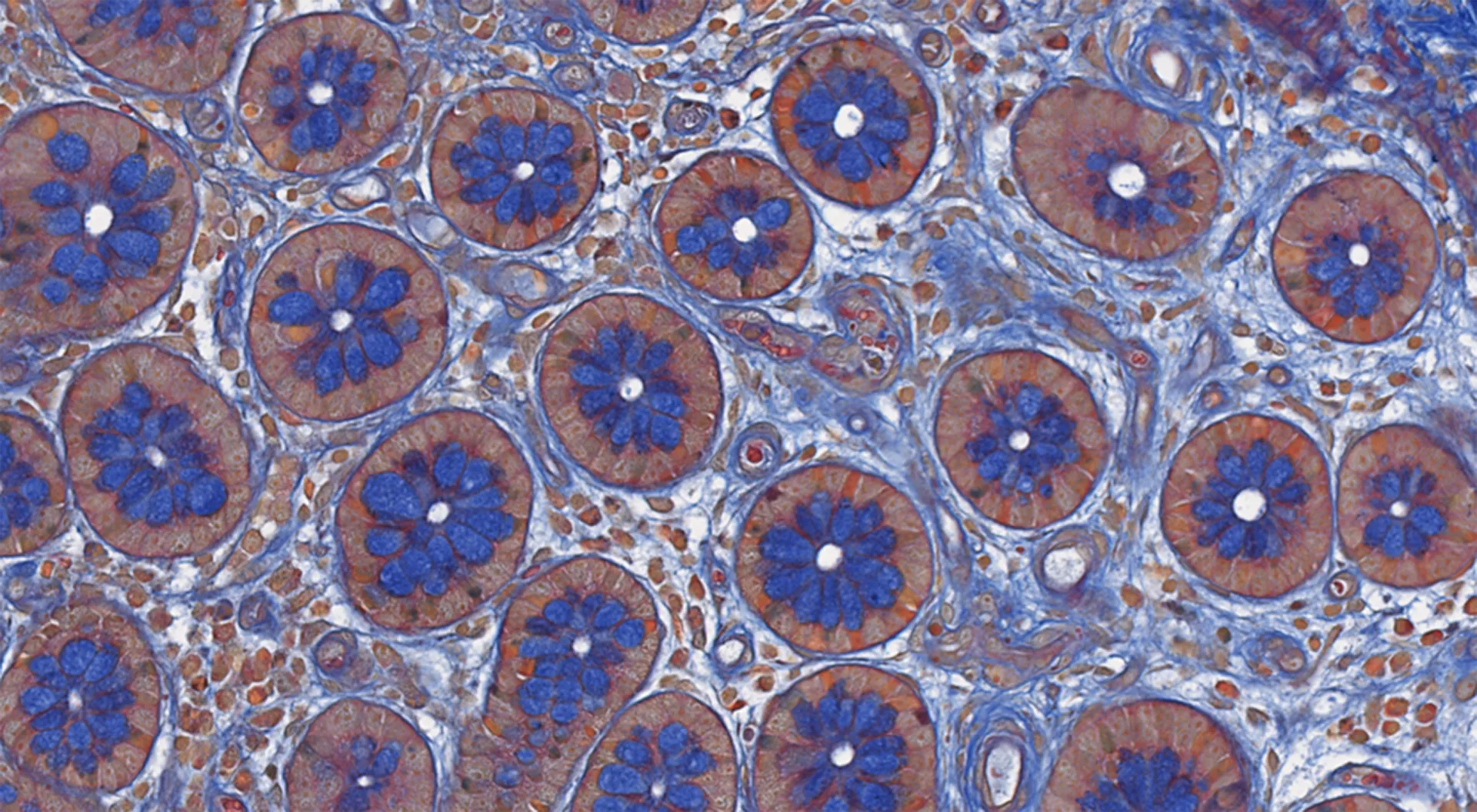 JJ_Photo_Colonic-mucosa-highlighted-by-Picro-Mallory-trichrome-special-stain-from-an-exploratory-study-for-Pulmonary-Arterial-Hypertension_IM_1Star.jpg